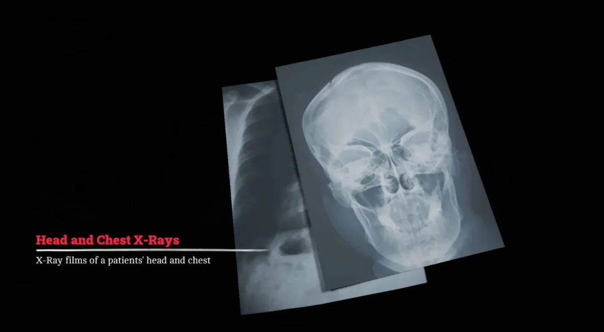 cQitDUsT7umTqrmFNCn4je.jpg How to take the X-Rays in Silent Hill Townfall